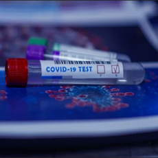На Подмосковных стройках введут обязательное тестирование на COVID-19